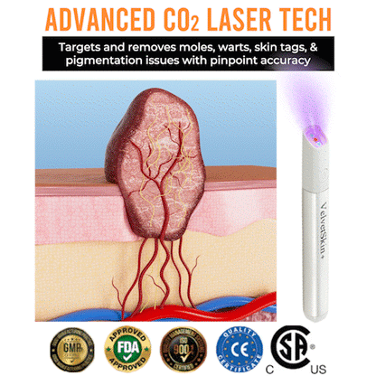 ☂DedMuller® VelvetSkin+Series ⚔️All-in-One Laser Eraser Pen🖊️ (🔬Powered by CO₂ laser technology – effectively removes moles, warts, skin tags, pigmentation spots, and other skin imperfections)